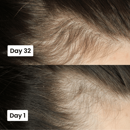 Scalp Hair Growth Serum – Advanced Tri‑Fix™